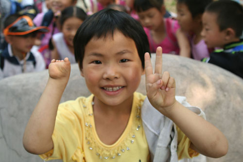 17 Girl with deformed hand gives sign with the other